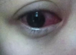 照片美瞳,照片中的美瞳魅力解析